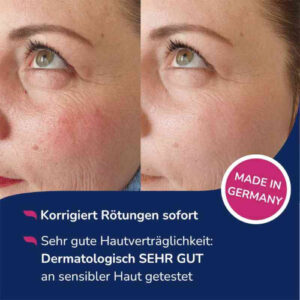 Дневной тонирующий флюид Allergika против покраснения кожи с SPF 50+ 30 мл