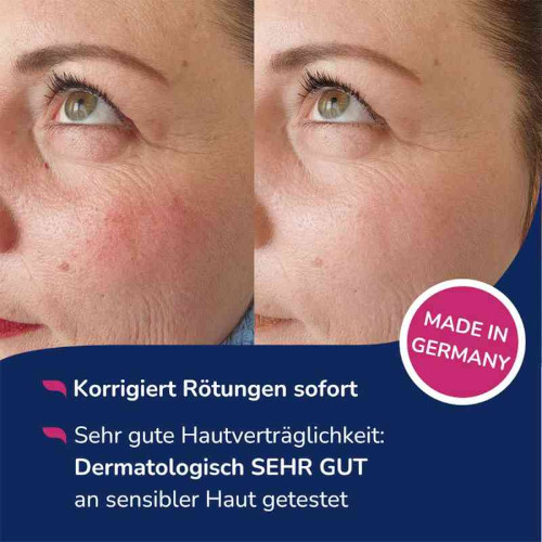 Дневной тонирующий флюид Allergika против покраснения кожи с SPF 50+ 30 мл — изображение 2